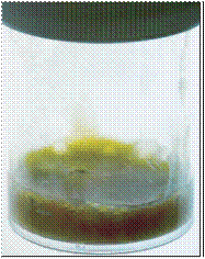 Sputum Colour Chart